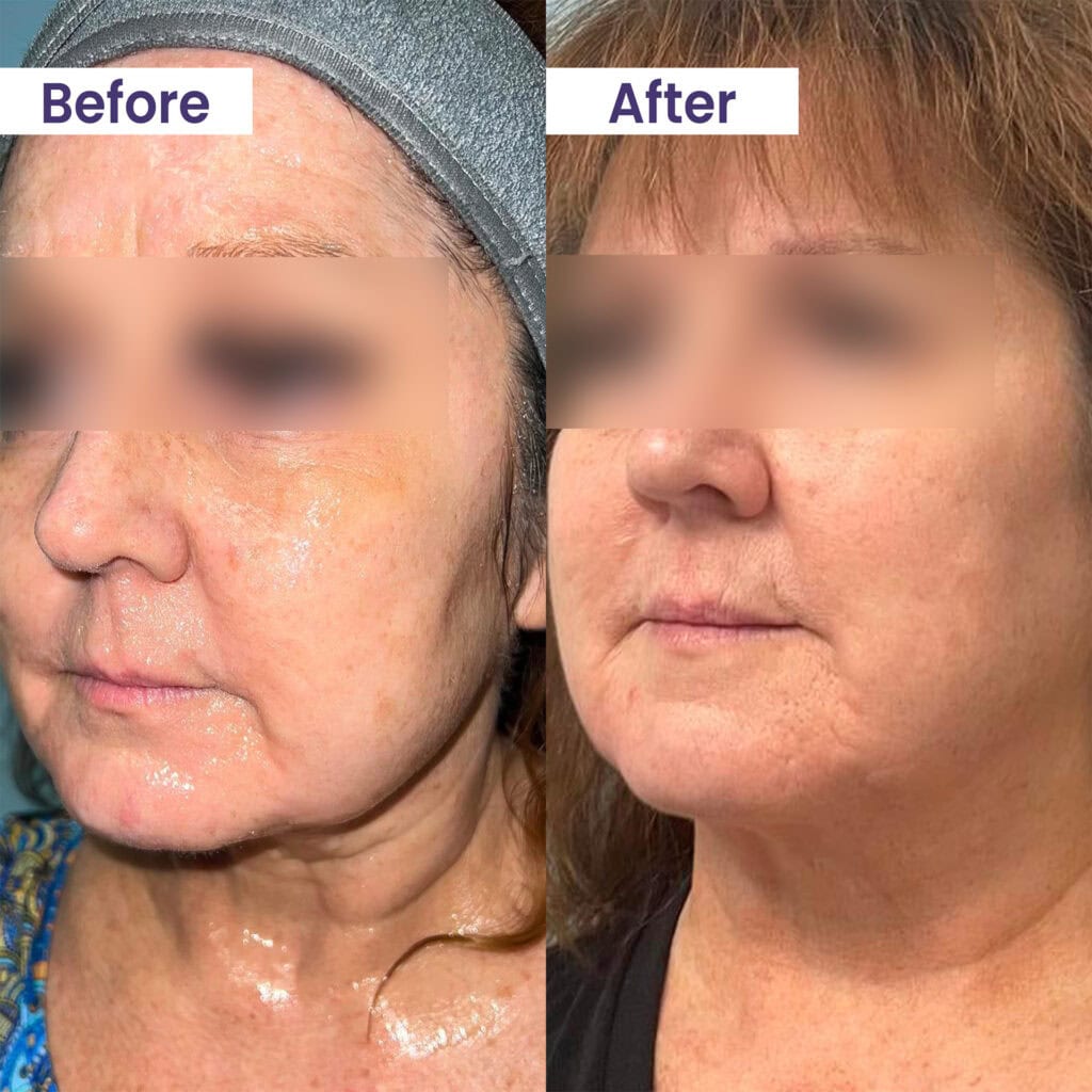 Transform Your Skin: Why Primebiome is the Ideal Solution for Women Over 35