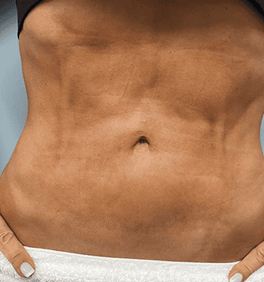 before-abs