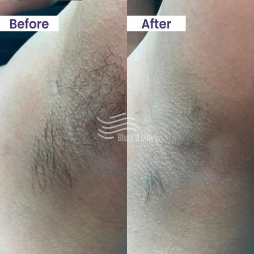 BEFORE & AFTER DEC 12 B-compressd