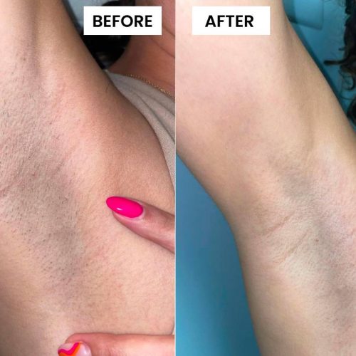 BEFORE & AFTER DEC 12 B